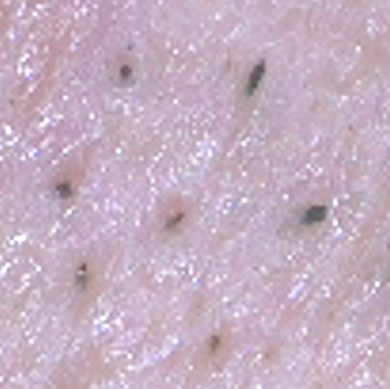 Magnified skin before irradiation